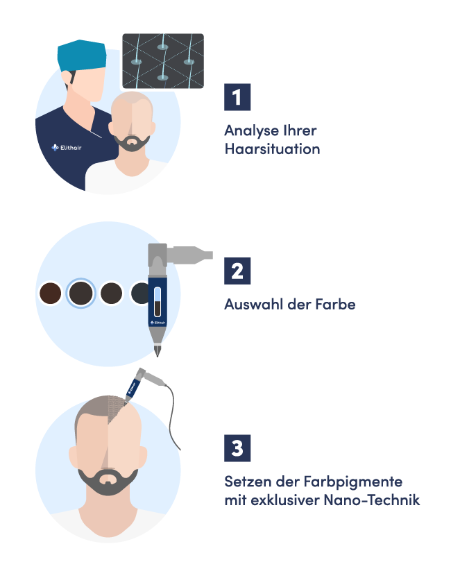 Infografik zu den 3 Schritten für die Haarpigmentierung in Deutschland